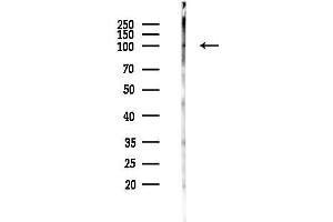 anti-Cadherin 26 (CDH26) (N-Term) antibody