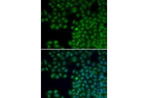 Immunofluorescence analysis of HeLa cells using NUDT6 antibody. (NUDT6 anticorps)
