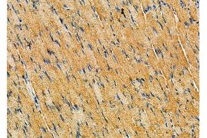 ABIN6260907 and ABIN6279340 at 1/100 staining rat muscle tissue by IHC-P.