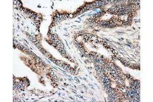 Immunohistochemical staining of paraffin-embedded liver tissue using anti-NIT2 mouse monoclonal antibody.
