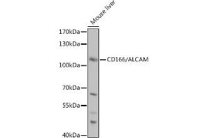 Western blot analysis of extracts of Mouse liver, using CD166/CD166/ALCAM antibody (ABIN6127405, ABIN6136759, ABIN6136760 and ABIN6219454) at 1:1000 dilution. (CD166 anticorps  (AA 28-180))