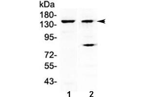 Western blot testing of 1) mouse liver and 2) human A431 lysate with FBXL11 antibody at 0. (KDM2A anticorps)