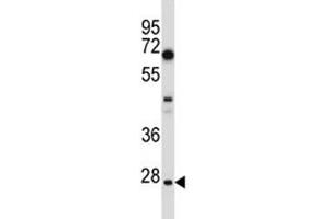 HES1 antibody western blot analysis in U251 lysate. (HES1 anticorps  (AA 3-32))