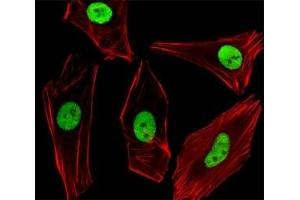 anti-Small Ubiquitin Related Modifier 2/3 (SUMO2/3) (AA 49-81) antibody