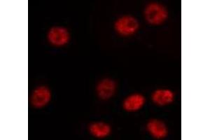 ABIN6275192 staining LOVO by IF/ICC. (HOXA6 anticorps  (Internal Region))