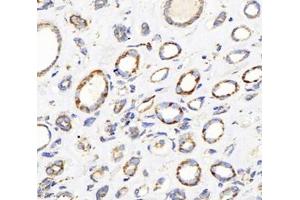 Immunohistochemistry analysis of paraffin-embedded human kidney using,DLAT (ABIN7073661) at dilution of 1: 1000 (CYB561 anticorps)