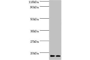 Western blot All lanes: RPS19 antibody at 2 μg/mL Lane 1: EC109 whole cell lysate Lane 2: 293T whole cell lysate Secondary Goat polyclonal to rabbit IgG at 1/15000 dilution Predicted band size: 17 kDa Observed band size: 17 kDa (RPS19 anticorps  (AA 1-145))