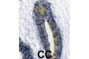 Immunohistochemistry (IHC) image for anti-Finkel-Biskis-Reilly Murine Sarcoma Virus (FBR-MuSV) Ubiquitously Expressed (FAU) antibody (ABIN2998456)