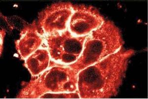 Immunofluorescent staining of A431 cells. (P-Cadherin anticorps  (AA 72-259))