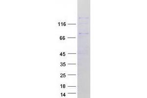 Validation with Western Blot