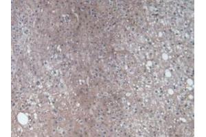 Detection of Kim1 in Human Liver Tissue using Monoclonal Antibody to Kidney Injury Molecule 1 (Kim1)