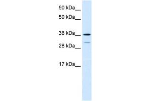 WB Suggested Anti-TCFL1 Antibody Titration:  0.
