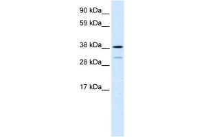 WB Suggested Anti-TCFL1 Antibody Titration:  0. (VPS72 anticorps  (Middle Region))