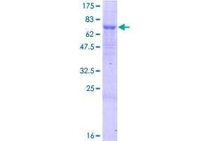 Image no. 1 for Sulfide Quinone Reductase-Like (SQRDL) (AA 1-450) protein (GST tag) (ABIN1321291)