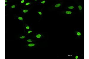 Immunofluorescence of purified MaxPab antibody to RCC1 on HeLa cell. (RCC1 anticorps  (AA 1-421))