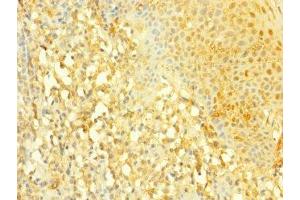 Immunohistochemistry of paraffin-embedded human tonsil tissue using ABIN7169906 at dilution of 1:100 (SLC4A7 anticorps  (AA 240-400))