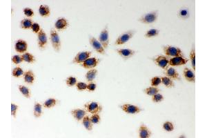 IHC analysis of LYRIC using anti-LYRIC antibody .