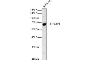 Western blot analysis of extracts of Rat lung, using  antibody (ABIN3021729, ABIN3021730, ABIN3021731 and ABIN6215663) at 1:500 dilution. (ATP6AP1 anticorps  (AA 90-390))