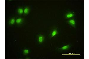 Immunofluorescence of monoclonal antibody to CRY1 on HeLa cell.