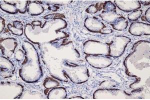 Immunohistochemistry (IHC) image for anti-Keratin 14 (KRT14) (C-Term) antibody (ABIN870551)