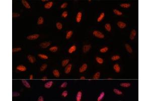 Immunofluorescence analysis of U-2 OS cells using ARID1B Polyclonal Antibody at dilution of 1:100.
