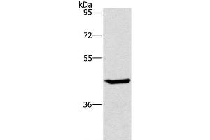 Western Blot analysis of HT-29 cell using GCK Polyclonal Antibody at dilution of 1:450 (GCK anticorps)