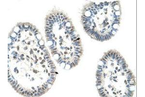 Image no. 1 for anti-Nuclear Receptor Subfamily 0, Group B, Member 1 (NR0B1) (AA 151-200) antibody (ABIN205081)