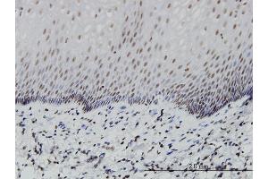 Immunoperoxidase of monoclonal antibody to PTF1A on formalin-fixed paraffin-embedded human esophagus.