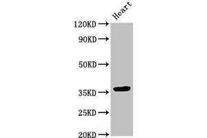 Western Blot Positive WB detected in: Rat heart tissue All lanes: NMI antibody at 3. (NMI anticorps  (AA 62-202))