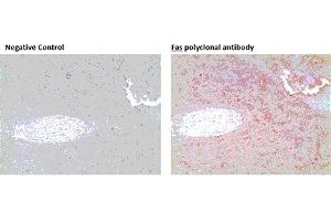 Immunohistochemistry analysis of formalin-fixed, paraffin-embedded human spleen tissue stained with Fas polyclonal antibody,  at 10 μg/mL. (FAS anticorps)