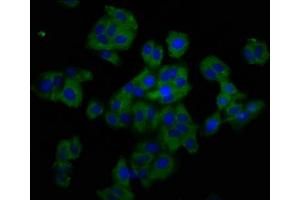 Immunofluorescence staining of HepG2 cells with ABIN7173864 at 1:200, counter-stained with DAPI. (TNFRSF19 anticorps  (AA 276-415))