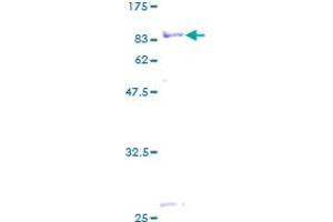 Image no. 1 for Myotubularin Related Protein 9 (MTMR9) (AA 1-549) protein (GST tag) (ABIN1311596)