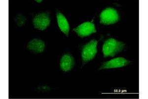 Immunofluorescence of purified MaxPab antibody to PSMB8 on HeLa cell. (PSMB8 anticorps  (AA 1-272))