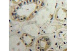 IHC-P analysis of Kidney tissue, with DAB staining. (PLA2R1 anticorps  (AA 385-643))