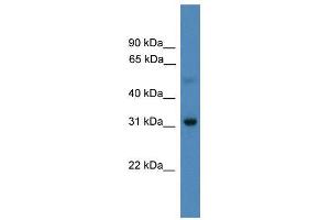 WB Suggested Anti-LBX1  Antibody Titration: 0. (Lbx1 anticorps  (N-Term))