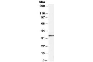 Western blot testing of human muscle lysate with STUB1 antibody at 0. (STUB1 anticorps)