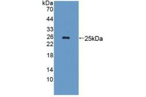 Detection of Recombinant LAMb3, Mouse using Polyclonal Antibody to Laminin Beta 3 (LAMb3) (Laminin beta 3 anticorps  (AA 367-568))