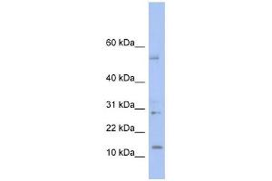 TD1 antibody used at 1 ug/ml to detect target protein. (TLX1 Neighbor anticorps  (Middle Region))