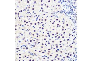 Immunohistochemistry of paraffin-embedded rat ovary using Phospho-IκBα-S36 Rabbit mAb (ABIN7268992) at dilution of 1:100 (40x lens).