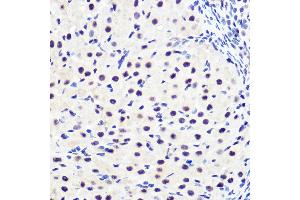 Immunohistochemistry of paraffin-embedded rat ovary using Phospho-IκBα-S36 Rabbit mAb (ABIN7268992) at dilution of 1:100 (40x lens). (NFKBIA anticorps  (pSer36))