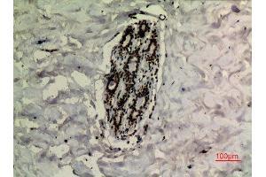 Immunohistochemistry (IHC) analysis of paraffin-embedded Human Breast, antibody was diluted at 1:100.