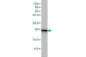 RRAS2 monoclonal antibody (M01A), clone 2D3-4B8 Western Blot analysis of RRAS2 expression in A-431 .