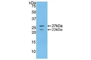 Detection of Recombinant FBN1, Mouse using Polyclonal Antibody to Fibrillin 1 (FBN1) (Fibrillin 1 anticorps  (AA 1703-1889))