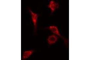 ABIN6278632 staining Hela cells by IF/ICC. (RPL14 anticorps  (Internal Region))