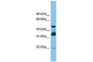 GBL antibody used at 1 ug/ml to detect target protein. (GBL anticorps)