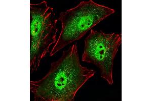 Fluorescent image of A549 cells stained with Mouse Sirt1 Antibody (C-term) (ABIN6242824 and ABIN6577619).