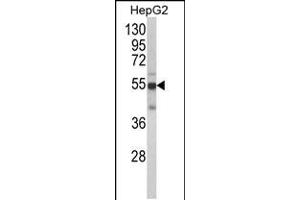 Western blot analysis of CYP2J2 Antibody in HepG2 cell line lysates (35ug/lane)