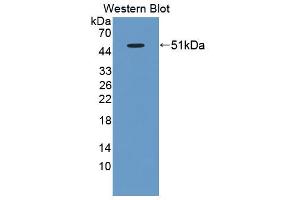 Western blot analysis of the recombinant protein. (BAFF anticorps  (AA 21-169))