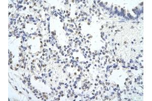 Rabbit Anti-MED6 Antibody        Paraffin Embedded Tissue:  Human Lung cell   Cellular Data:  Epithelial cells of renal tubule  Antibody Concentration:   4. (MED6 anticorps  (C-Term))