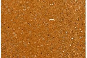 ABIN6262030 and ABIN6272943 at 1/100 staining Mouse brain tissue by IHC-P.